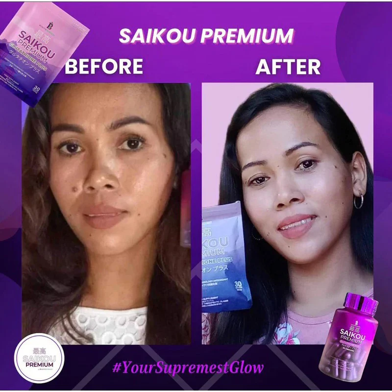 SAIKOU Premium Glutathione Plus 60 Capsules - Image 5